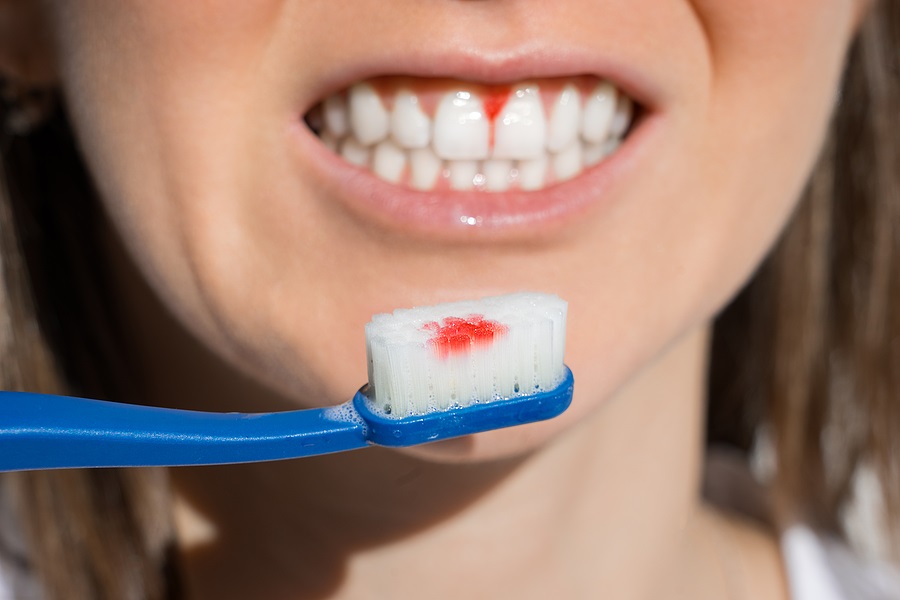 Teeth and Gum Problems