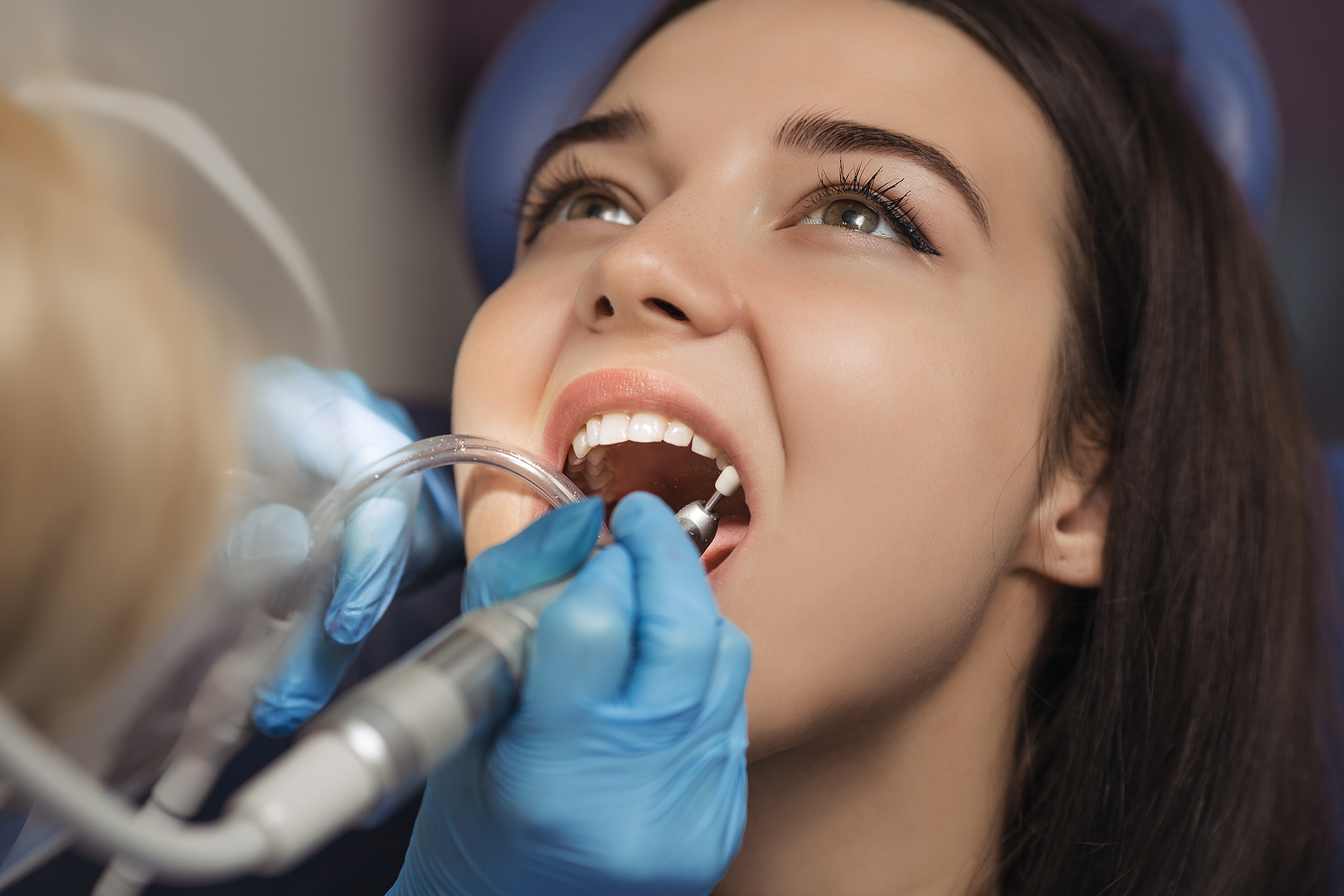 What to Expect After Tooth Extraction: A Guide to Proper Aftercare