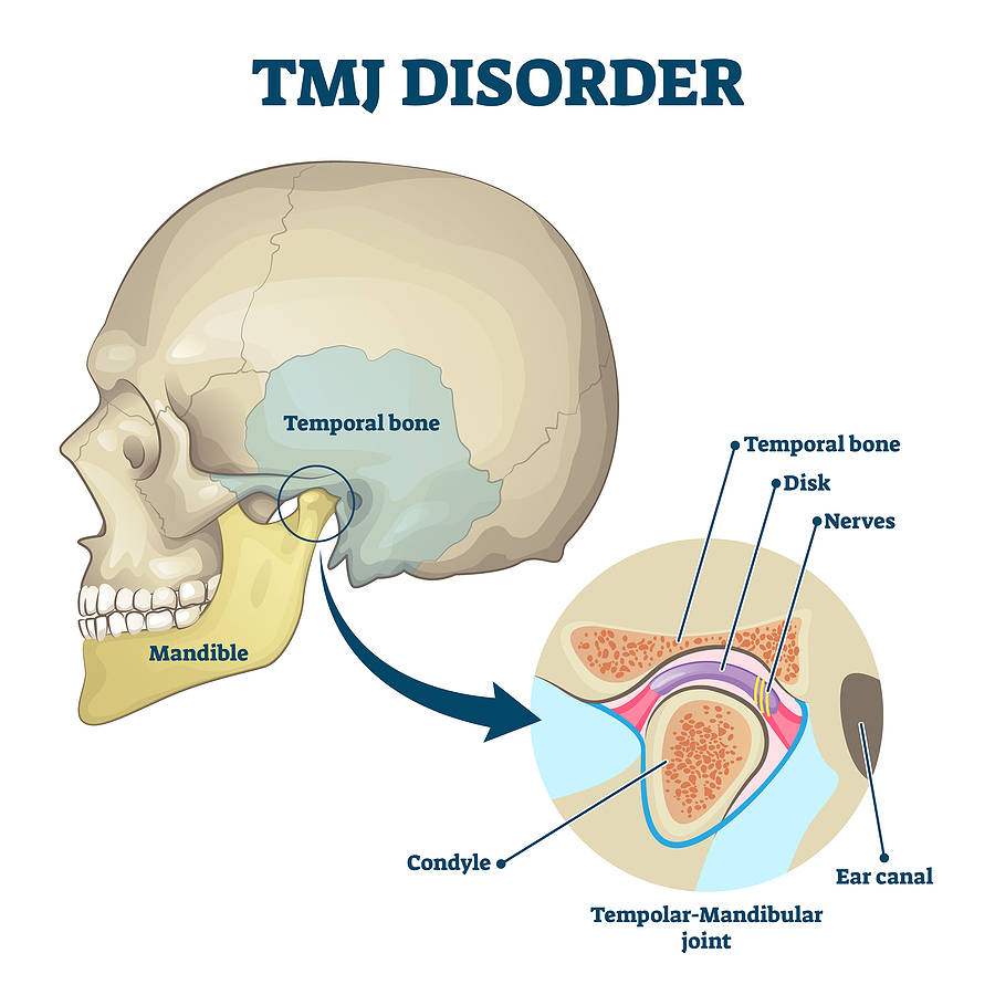 Comprehensive TMJ & Jaw Evaluation in Carson City, NV: Restoring Comfort and Functionality